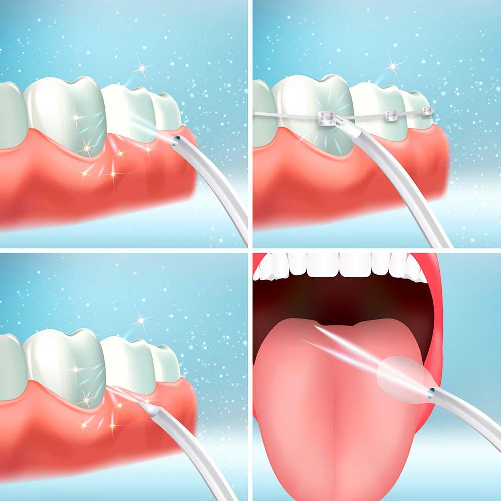 Irrigador dental recargable portátil, denter, 4 w, 6 x 6 x 21 cm